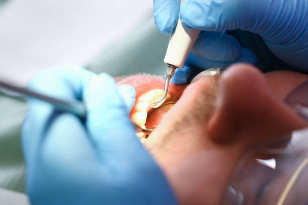 Best Emergency Root Canal Therapy in Roan Mountain, TN